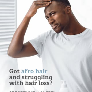 Are you experiencing hair thinning or patchy loss? Have Afro-textured hair?

We’re offering 4 candid