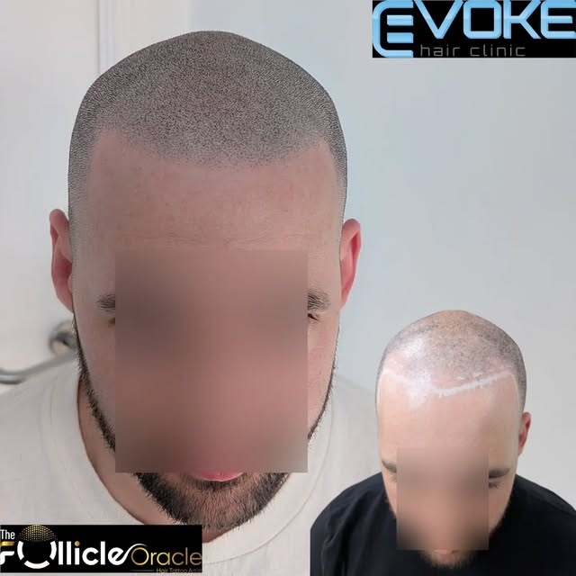 Thinning hair, don't care!! Because there are so many options out there to help either if it's knock