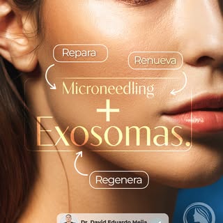 ✨ Microneedling + Exosomas: una combinación que repara, renueva y regenera la piel.

El microneedlin