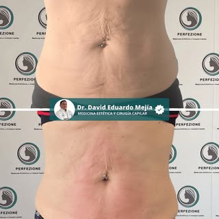 Cuando la piel pierde firmeza, lo que más ayuda es activar su soporte desde dentro.

En este antes y