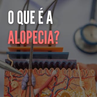 Sabe o que é alopecia?
O @dr.henriquemachado explica.

#transplantecapilar #alopecia #alopeciaandrog