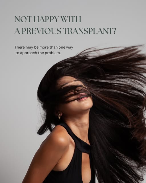 A previous hair transplant does not always mean the conversation is over. 

Some patients seek furth