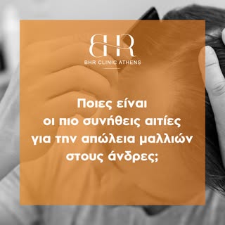 🔎 Ποιες είναι οι πιο συνήθεις αιτίες για την απώλεια μαλλιών στους άνδρες;

🔸 Κληρονομικοί παράγον