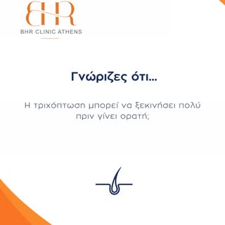 💡 Γνώριζες ότι...
η τριχόπτωση μπορεί να ξεκινήσει πολύ πριν γίνει ορατή;

Η διαδικασία της αραίωση