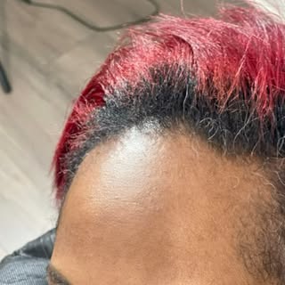 Do you have thinning edges? Schedule a free consultation and let’s get you spring/summer ready!