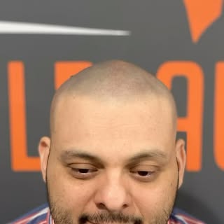 ✅ Great Costumer Service 

✅ Custom Tailored Hairlines 

✅ 5 Star Results ⭐️⭐️⭐️⭐️⭐️