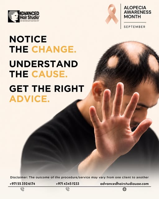 Hair loss is not just about appearance — it can be a sign of an underlying condition.

This Alopecia