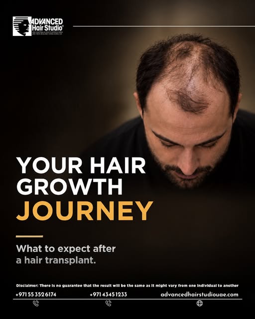 A hair transplant is a journey, not an overnight change.

From the first days of healing to temporar