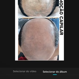 Mais um caso que chegou após uma tentativa de fio a fio que perdeu definição, formou manchas e acabo