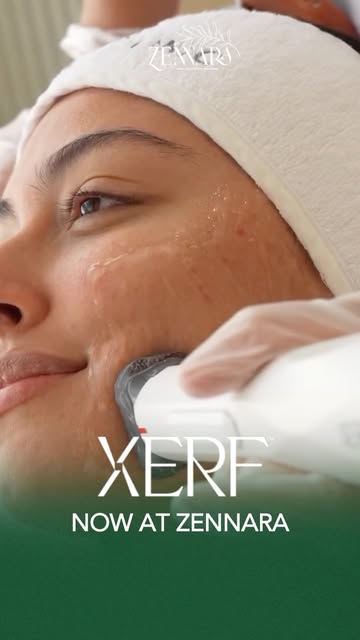 HYDERABAD, XERF™️ IS FINALLY HERE. 

And we’re celebrating with a Special 2-Day Launch Offer, availa