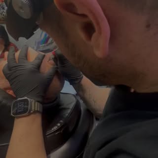 Scalp Micropigmentation is affordable compared to hair transplant surgery which may or may not cure 
