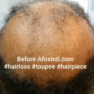 Female Toupee Toppers, Before & After Application 
#hairpiece #toupee #hairlosssolutions #womenempow