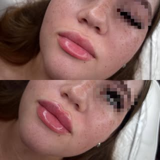 0.5ml Freshen Up 🩵