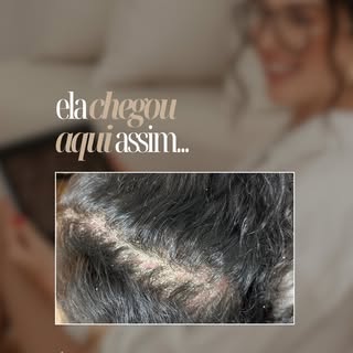 Quero compartilhar com vocês a trajetória da Mari com a Terapia Capilar, foi assim, que ela chegou a
