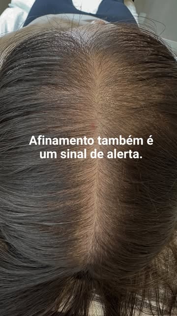 Perceber mudanças na espessura dos fios e na densidade do cabelo merece atenção, principalmente quan
