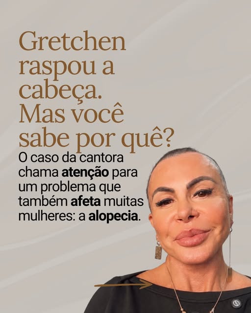 O caso da Gretchen traz um alerta: a alopecia pode evoluir silenciosamente e de forma progressiva. M