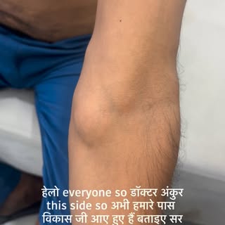 Lipoma Removal

A lipoma is a common, benign fatty lump that can often be removed through a small, c