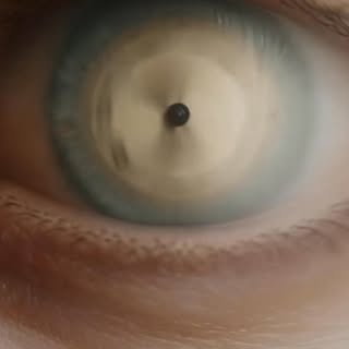 Cataract is not just a part of aging—it can slowly steal the clarity of your vision.

If you’re expe