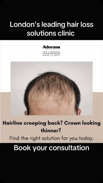 Hairline creeping back? Crown looking thinner?

Don’t wait for hair loss to become harder to manage.