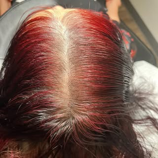 Come get your fill. Right side treated. Left side isn’t! 

Scalp Micropigmentation is a method of ta