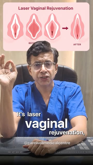 Laser vs Surgical Vaginoplasty — which option is right for you? 🤔

In this reel, we break down the 