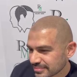 Il mio EGO• 😍😍😍😍😍🤣😃❤️

🌍Fedele ALLE VOSTRE ASPETTATIVE •

Tricopimentazione•🔥🔥🔥 •

GRAZIE