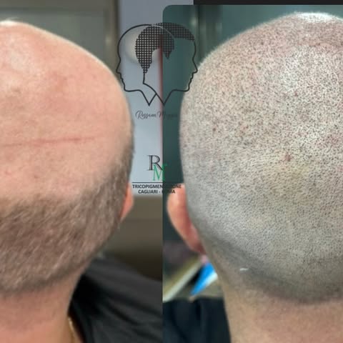 Tricopimentazione•🔥🔥🔥 •

GRAZIE PER LA FIDUCIA 🦉🐨🧡®️💯🌶️🍀😍

☎️ +39 351 7597445
📩 rossana@t