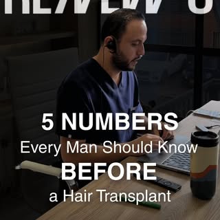 📊 The numbers behind hair loss are more telling than most men realize.

Before making any decision 