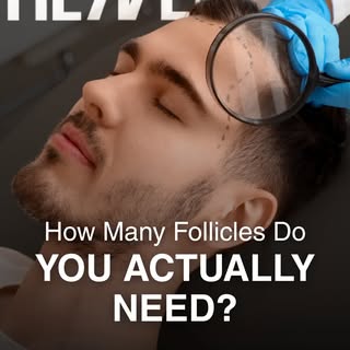 One of the most common questions we hear is: “How many follicles will I need?” 🤔

👉🏻 The answer d