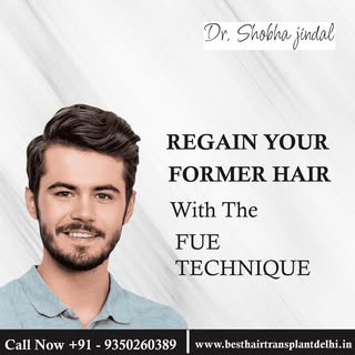 Regain Your Formal Hair
With The FUE TECHNIQUE

www.besthairtransplantdelhi.in/best-hair-transplant-