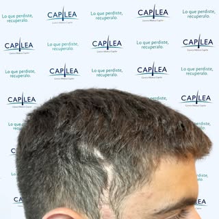 Lo que antes llamaba la atención... hoy pasa desapercibido.
Este antes y después muestra cómo un imp