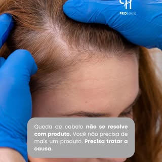 Queda de cabelo não se trata com promessas rápidas.

Se trata com diagnóstico, cuidado e tratamento 