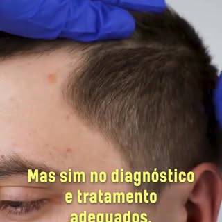 🚨 Seu cabelo está caindo mais do que o normal? 🚨

Se você já tentou de tudo e ainda vê seus fi