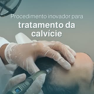 Você já ouviu falar em MMP?
A Microinfusão de Medicamentos na Pele é um tratamento avançado para cal
