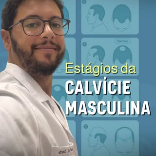 👱🏻‍♂️Você sabe em qual estágio da calvície está?

A queda de cabelo tem graus diferentes, e quanto