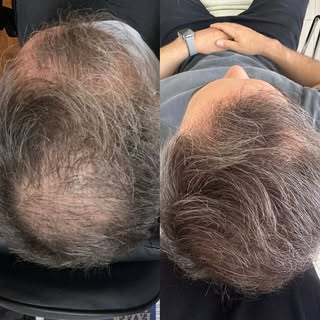 Não é só sobre cabelo, é sobre autoestima! ✨