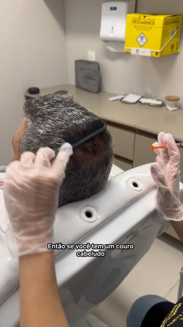 E você sabe se a alopecia já começou a aparecer por aí? Ninguém fica careca do nada, ela começa deva