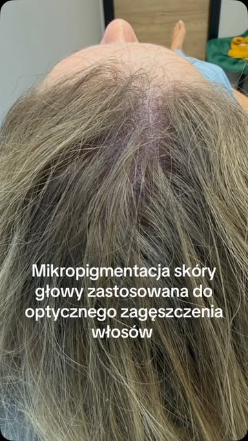 Zastanawiasz się, czy mikropigmentacja to rozwiązanie dla Ciebie?
Nie musisz podejmować decyzji od r