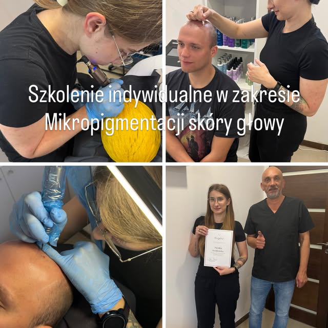 Szkolenie indywidualne w zakresie Mikropigmentacji skóry głowy