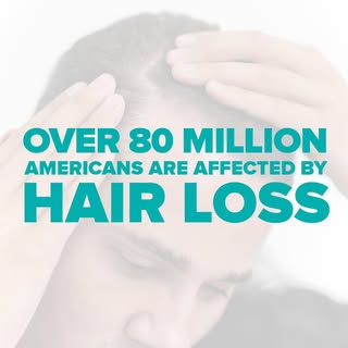 While commonly associated with aging, hair loss doesn’t discriminate by age or gender. Both men and 