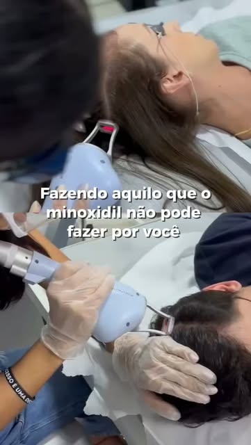 A saúde e o crescimento dos fios dependem de vários fatores — e existem tratamentos que atuam direta