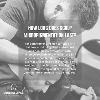 How Long Does Scalp Micropigmentation Last?

For both women and men suffering with hair loss or thin