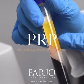 That golden layer in the tube? That’s platelet-rich plasma - separated from a small sample of your o