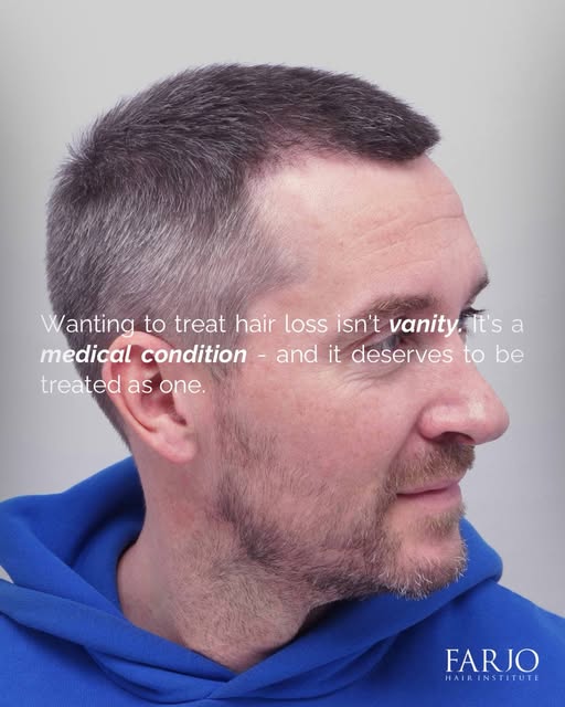 Nobody calls it vanity to treat any other medical condition. Hair loss is no different. If it’s affe