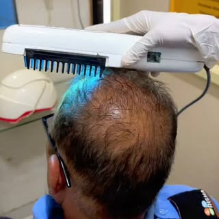 ☎️8431117777 ✨ Permanent Solution for Early Baldness & Hair Fall! ✨
Now a golden opportunity for eve