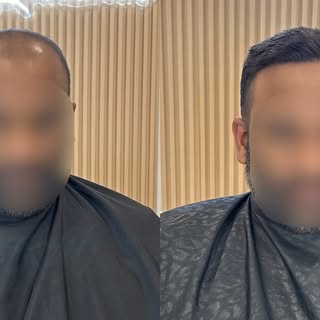 Male Hair Replacement 🔥

We tailor your look to you for that renewed confidence to be YOU!

We offe