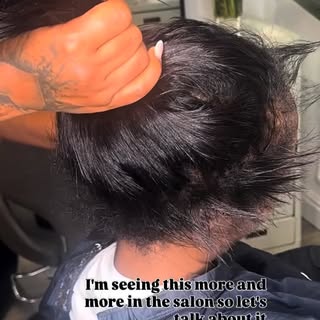Your edges need TLC.

Constant edge control, brushing, and laying baby hair can stress your hairline