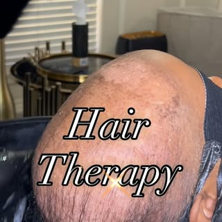 ✨Natural Hair Replacement At It’s Finest✨

Are you experiencing hair loss, shedding, or thinning? So