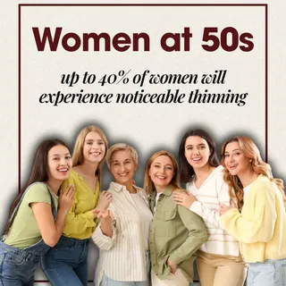 Men seem to get all the attention when it comes to hair loss, but here is a statistic that might sur