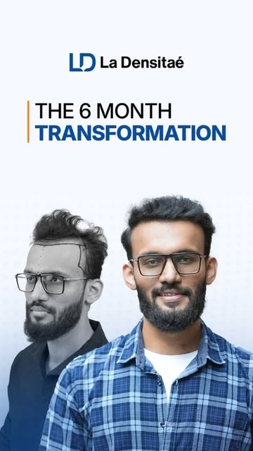 One rejection made him take his hairline seriously.
 Six months later, he says the decision was wort